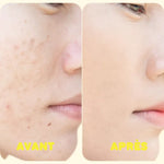 Hydra Mission - Gel hydratant non gras