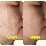 Hydra Mission - Gel hydratant non gras