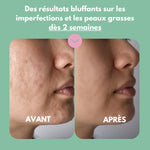 Masque crémeux matifiant et anti imperfections (Pack de 5 + Shaker)