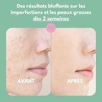 Masque crémeux matifiant et anti imperfections (Pack de 5 + Shaker)