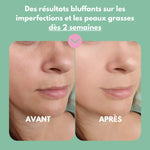 Masque crémeux matifiant et anti imperfections (Pack de 5 + Shaker)