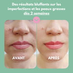 Masque crémeux matifiant et anti imperfections (Pack de 5 + Shaker)